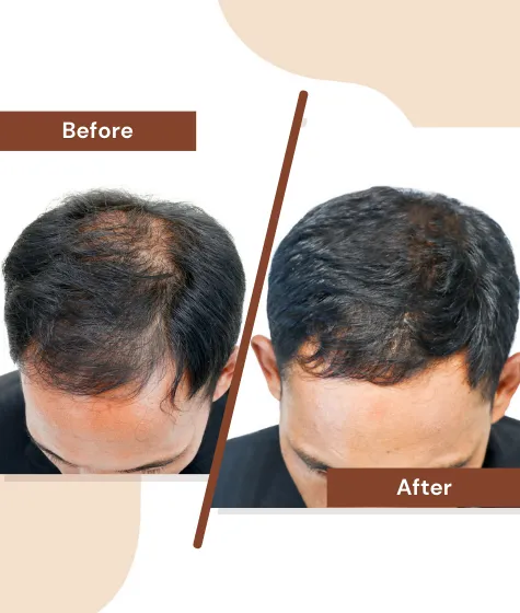 Hair-Treatment1