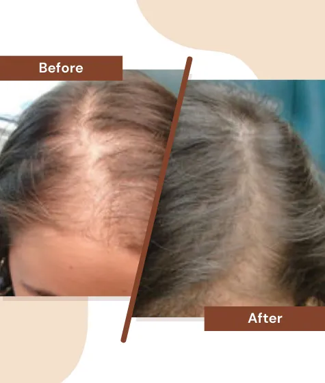 Hair-Treatment2