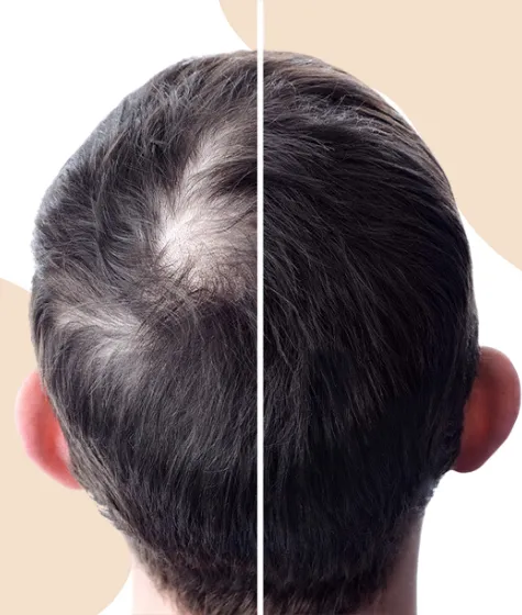 Hair-Treatment3